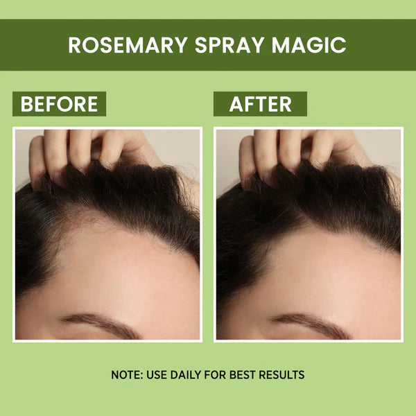 Rosemary Water, Hair Spray For Regrowth Buy 1 Get 2 Free